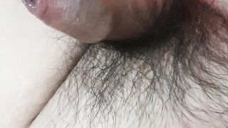 Burn penis hair