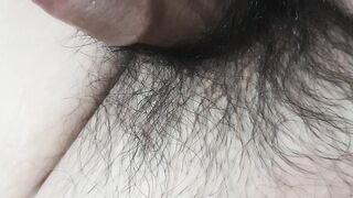 Burn penis hair