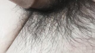 Burn penis hair
