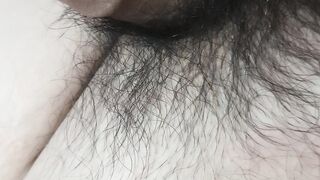 Burn penis hair