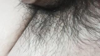 Burn penis hair