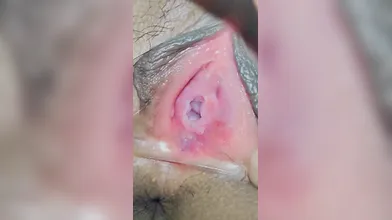 Teen loose wet pussy
