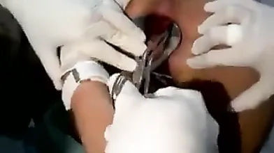 Dildo Accidentally Left In Her Asshole