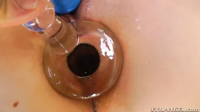 Buttholes #20