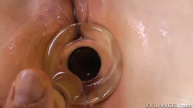 Buttholes #20